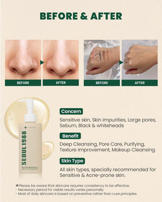 KSECRET Seoul 1988 Cleansing Oil: Pine Cica 1% + Probiotics 200mL - Kbeauty Canada