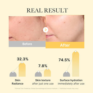 MEDICUBE Kojic Acid Tumeric Brightening Gel Mask