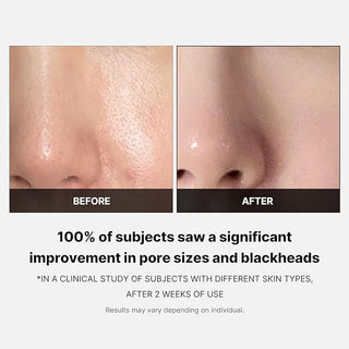 MEDICUBE Zero Pore Pad 2.0 (70pcs)